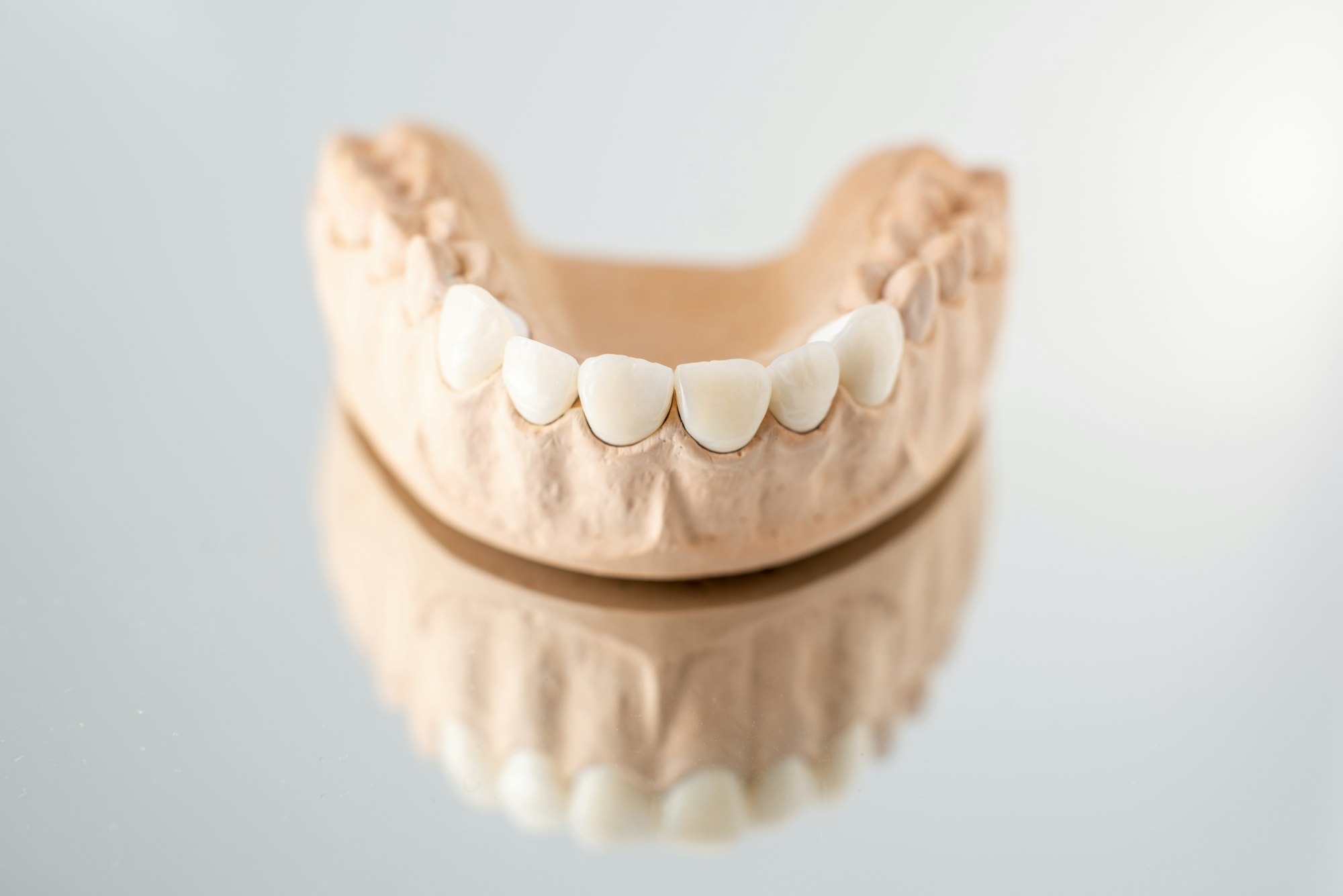 Model of artificial jaw with veneers