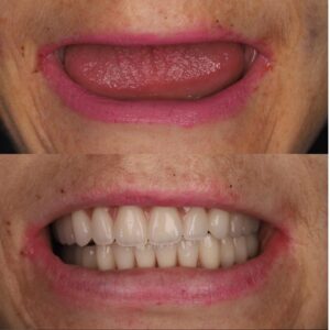 Dr-Abu-Before-After.jpg