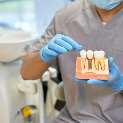 qualified-dentist-in-mask-a-gloves-with-a-dental-implant-model (1)